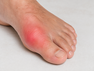 足の親指の付け根が腫れて痛むイメージ